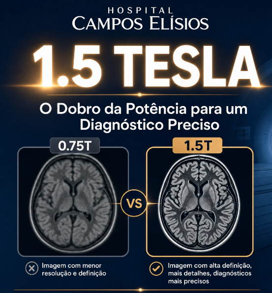 Comparação ressonância 0,75T e 1,5 Tesla no Hospital Campos Elísios